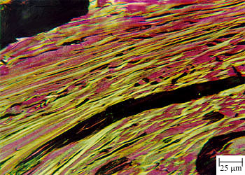p01