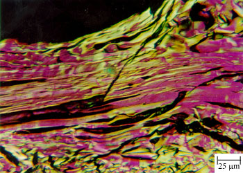 P03